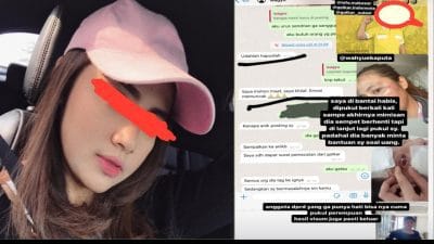 Oknum Anggota DPRD Takalar Diduga Aniaya Kekasihnya Hingga Memar Otak