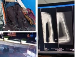 Korban Pengeroyokan Harus di Operasi: Satu Pelaku Diamankan Polres Takalar